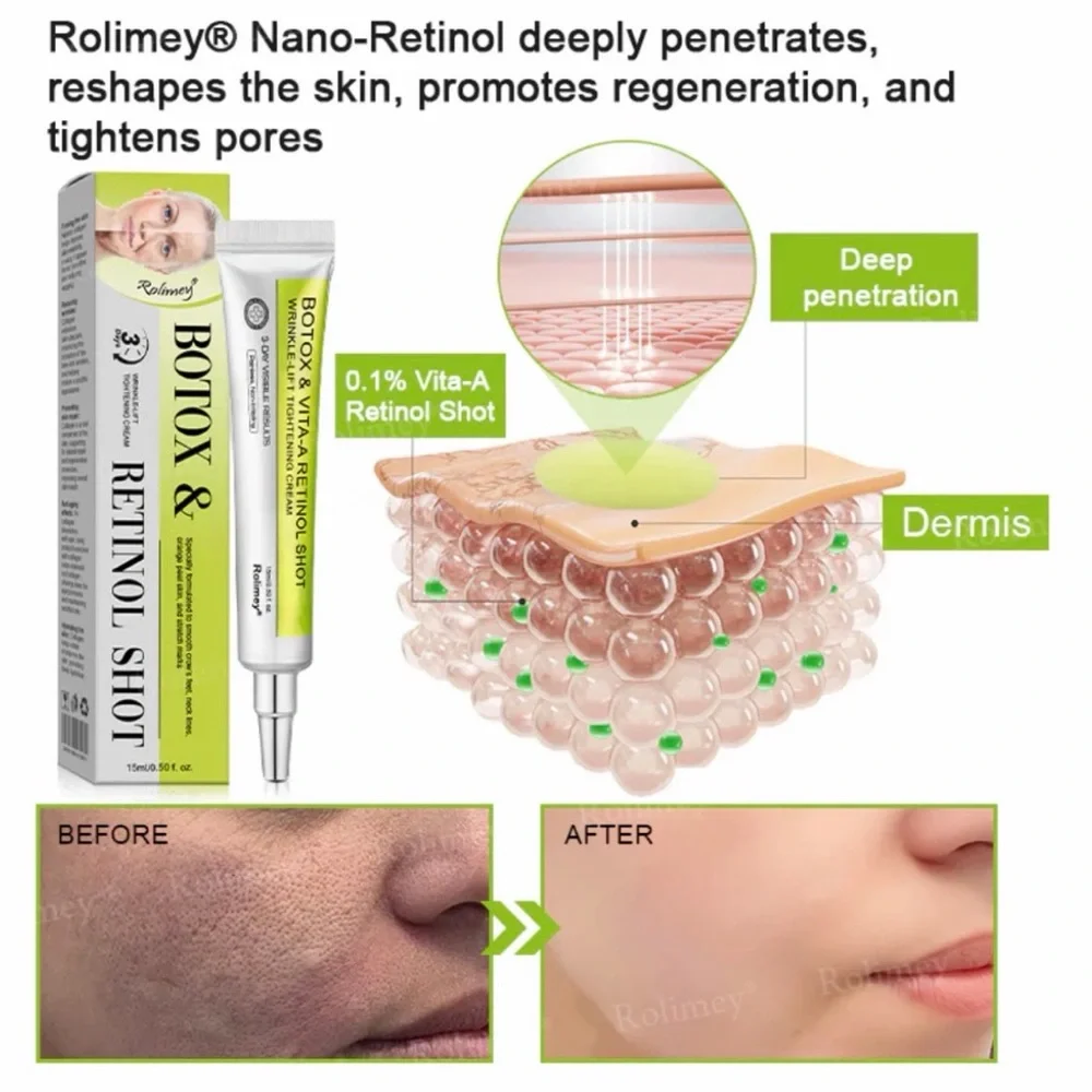 Botox & Retinol Shot Anti-Aging Cream